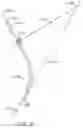 Fig. 40 - Curved cannula surgical system