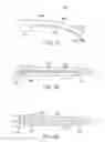 Fig. 10 - Curved cannula surgical system control