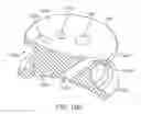 Fig. 32 - Curved cannula surgical system control