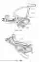 Fig. 34 - Curved cannula surgical system control