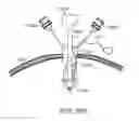 Fig. 37 - Curved cannula surgical system control