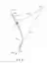 Fig. 40 - Curved cannula surgical system control