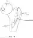 Fig. 05 - Method and apparatus for re-attaching the labrum to the acetabulum, including the provision and use of a novel suture anchor system