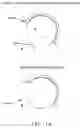 Fig. 15 - Method and apparatus for re-attaching the labrum to the acetabulum, including the provision and use of a novel suture anchor system
