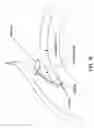 Fig. 19 - Method and apparatus for re-attaching the labrum to the acetabulum, including the provision and use of a novel suture anchor system