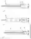 Fig. 26 - Method and apparatus for re-attaching the labrum to the acetabulum, including the provision and use of a novel suture anchor system