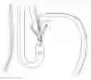 Fig. 01 - Method for Applying Surgical Clips Particularly Useful in the Endoluminal Treatment of Gastroesophageal Reflux Disease (GERD)