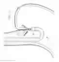 Fig. 11 - Method for Applying Surgical Clips Particularly Useful in the Endoluminal Treatment of Gastroesophageal Reflux Disease (GERD)