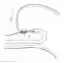 Fig. 13 - Method for Applying Surgical Clips Particularly Useful in the Endoluminal Treatment of Gastroesophageal Reflux Disease (GERD)