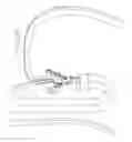 Fig. 15 - Method for Applying Surgical Clips Particularly Useful in the Endoluminal Treatment of Gastroesophageal Reflux Disease (GERD)