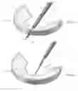 Fig. 13 - Method and apparatus for meniscal repair