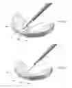 Fig. 15 - Method and apparatus for meniscal repair