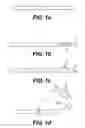 Fig. 02 - Suture passing devices and methods