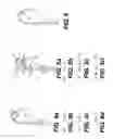 Fig. 05 - Suture passing devices and methods