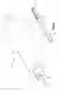 Fig. 02 - Multi-stitch anchor suture-based soft tissue repair system