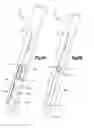 Fig. 12 - Multi-stitch anchor suture-based soft tissue repair system
