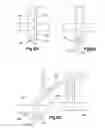 Fig. 14 - Multi-stitch anchor suture-based soft tissue repair system