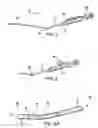 Fig. 02 - Articulating suturing device and method