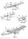 Fig. 04 - Articulating suturing device and method