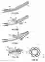Fig. 05 - Articulating suturing device and method
