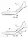 Fig. 07 - Articulating suturing device and method