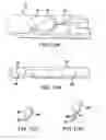 Fig. 09 - Articulating suturing device and method