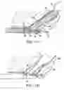 Fig. 11 - Articulating suturing device and method