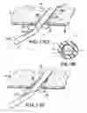 Fig. 14 - Articulating suturing device and method