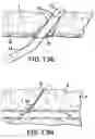 Fig. 15 - Articulating suturing device and method