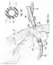 Fig. 25 - Articulating suturing device and method