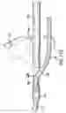 Fig. 27 - Articulating suturing device and method
