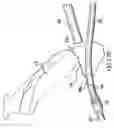 Fig. 28 - Articulating suturing device and method