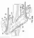 Fig. 29 - Articulating suturing device and method