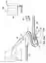 Fig. 33 - Articulating suturing device and method