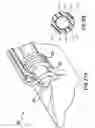 Fig. 35 - Articulating suturing device and method