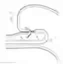 Fig. 11 - Method for Applying Surgical Clips Particularly Useful in the Endoluminal Treatment of Gastroesophageal Reflux Disease (GERD)
