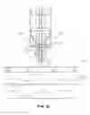 Fig. 11 - Absorbable anchor for hernia mesh fixation