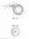 Fig. 03 - Symmetrical drive system for an implantable restriction device