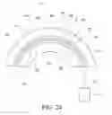 Fig. 10 - Symmetrical drive system for an implantable restriction device