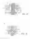 Fig. 11 - Symmetrical drive system for an implantable restriction device