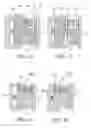 Fig. 17 - Symmetrical drive system for an implantable restriction device