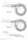 Fig. 31 - Symmetrical drive system for an implantable restriction device