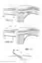 Fig. 32 - Symmetrical drive system for an implantable restriction device