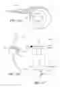 Fig. 38 - Symmetrical drive system for an implantable restriction device