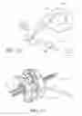 Fig. 40 - Symmetrical drive system for an implantable restriction device