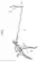 Fig. 02 - Medical instrument with multi-joint arm