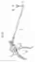 Fig. 03 - Medical instrument with multi-joint arm