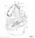 Fig. 03 - METHODS, DEVICES, KITS AND SYSTEMS FOR DEFUNCTIONALIZING THE CYSTIC DUCT