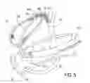 Fig. 06 - METHODS, DEVICES, KITS AND SYSTEMS FOR DEFUNCTIONALIZING THE CYSTIC DUCT