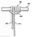 Fig. 01 - ARTICULATING SUTURING AND DEVICE AND METHOD